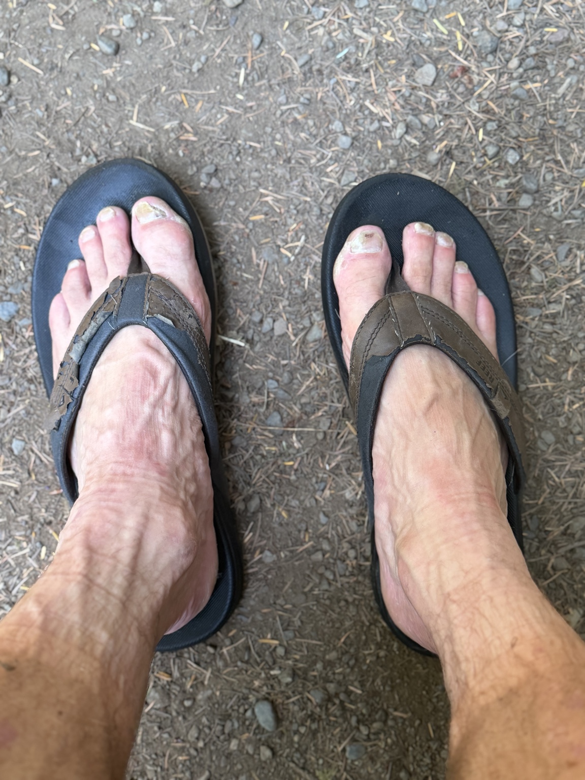 Matthew’s tired feet in worn sandals after a long day on the road